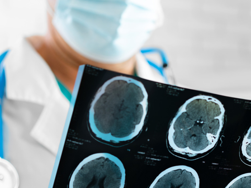 photo of doctor looking at MRI image of brain
